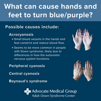 What can cause hands and feet to turn blue/purple? Possible causes include acrocyanosis, peripheral cyanosis, central cyanosis, and Raynaud's syndrome.
