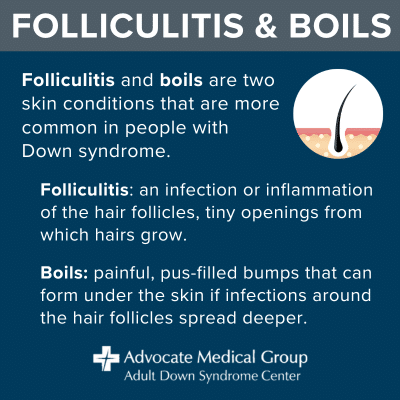 Folliculitis and boils are two skin conditions that are more common in people with Down syndrome. Folliculitis is an infection or inflammation of the hair follicles, tiny openings from which hairs grow. Boils are painful, pus-filled bumps that can form under the skin if infections around the hair follicles spread deeper.