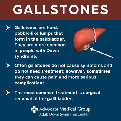 Gallstones are hard, pebble-like lumps that form in the gallbladder. They are more common in people with Down syndrome. Often gallstones do not cause symptoms and do not need treatment; however, sometimes they can cause pain and more serious complications. The most common treatment is surgical removal of the gallbladder.