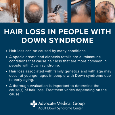 Hair Loss in People with Down Syndrome. Hair loss can be caused by many conditions. Alopecia areata and alopecia totalis are autoimmune conditions that cause hair loss that are more common in people with Down syndrome. Hair loss associated with family genetics and with age may occur at younger ages in people with Down syndrome due to early aging. A thorough evaluation is important to determine the cause(s) of hair loss. Treatment varies depending on the cause.