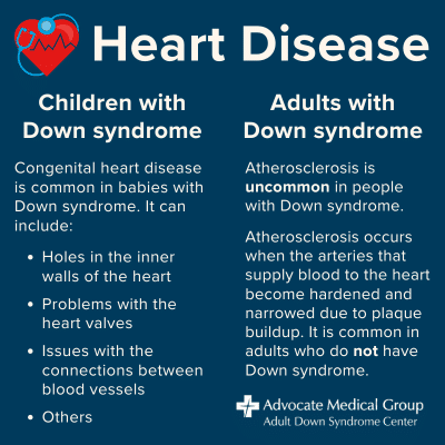 Heart disease. Children with Down syndrome - Congenital heart disease is common in babies with Down syndrome. It can include holes in the inner walls of the heart, problems with the heart valves, issues with the connections between blood vessels, and others. Adults with Down syndrome - Atherosclerosis is uncommon in people with Down syndrome. Atherosclerosis occurs when the arteries that supply blood to the heart become hardened and narrowed due to plaque buildup. It is common in adults who do not have Down syndrome.