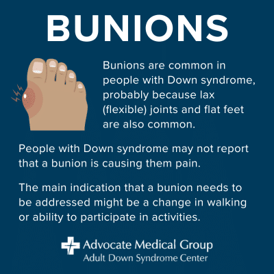 Bunions are common in people with Down syndrome, probably because lax (flexible) joints and flat feet are also common. People with Down syndrome may not report that a bunion is causing them pain. The main indication that a bunion needs to be addressed might be a change in walking or ability to participate in activities.