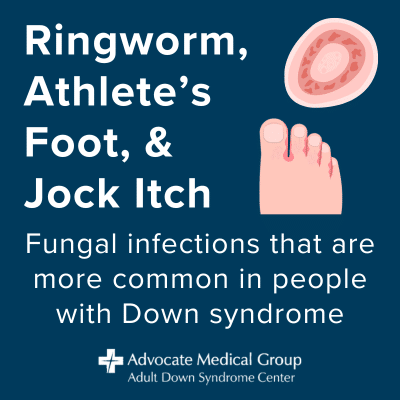 Ringworm, athlete's foot, and jock itch. Fungal infections that are more common in people with Down syndrome