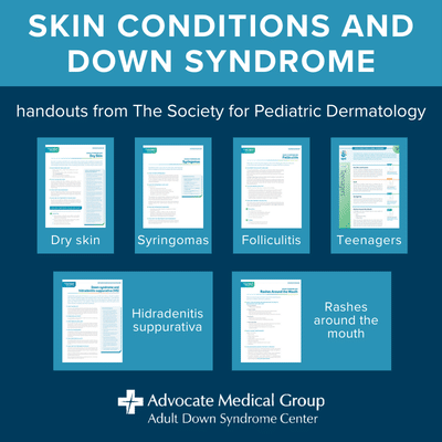 Skin conditions and Down syndrome. Handouts from The Society for Pediatric Dermatology. Dry skin, syringomas, folliculitis, teenagers, hidradenitis suppurativa, rashes around the mouth
