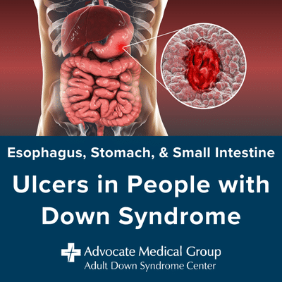 Ulcers in people with Down syndrome