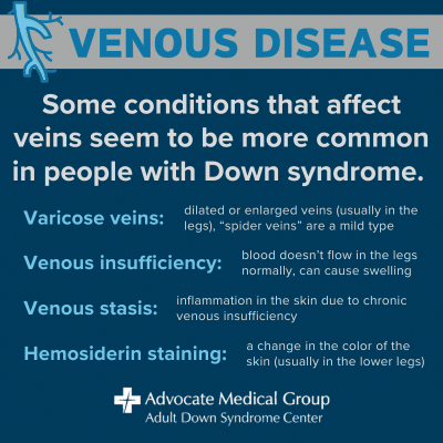 Venous disease. Some conditions that affect veins seem to be more common in people with Down syndrome. Varicose veins. Venous insufficiency. Venous stasis. Hemosiderin staining.