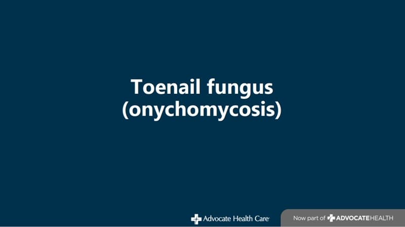 toenail_fungus